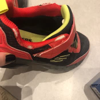 Skechers Çocuk Ayakkabısında Erken Deformasyon Ve Yetersiz Müşteri Desteği