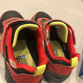 Skechers Çocuk Ayakkabısında Erken Deformasyon Ve Yetersiz Müşteri Desteği