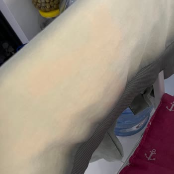 Domol Leke Çıkarıcı Kıyafetimin Rengini Soldurdu, Mağduriyetimin Giderilmesini İstiyorum