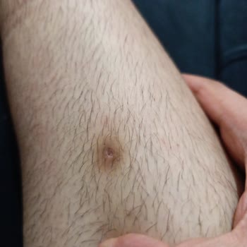 Zeynep Beauty Center Lazer Epilasyon Ve Zayıflama Hizmetlerinde Maddi Ve Manevi Mağduriyet