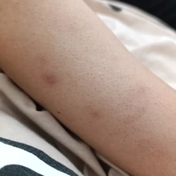 Zeynep Beauty Center Lazer Epilasyon Ve Zayıflama Hizmetlerinde Maddi Ve Manevi Mağduriyet