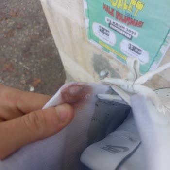 Nike Ayakkabı Ayağımı Yaraladı, Mağaza Sorunu Kabul Etmedi