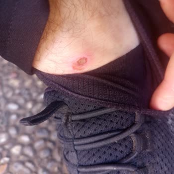 Nike Ayakkabı Ayağımı Yaraladı, Mağaza Sorunu Kabul Etmedi