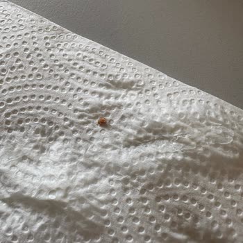 Altınkılıç Laktozsuz Kefirin İçinden Yabancı Madde Çıktı, Sağlığım Tehlikeye Girdi