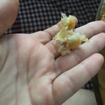 Superfresh Soğan Halkasında Yabancı Cisimle Karşılaştım