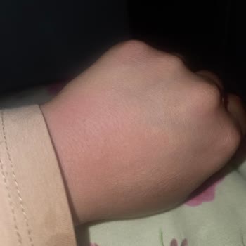 Mi experiencia con Palmolive, jabón causa irritación y picazón intensa