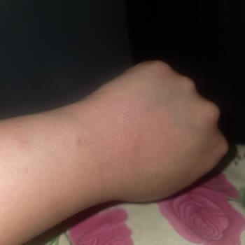 Mi experiencia con Palmolive, jabón causa irritación y picazón intensa