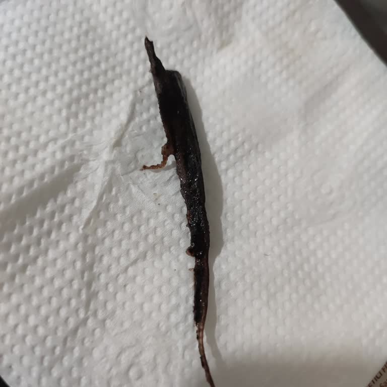 Aldığım Çikolata Sosundan Böcek Çıktı, Hijyen Endişesi Yaşıyorum