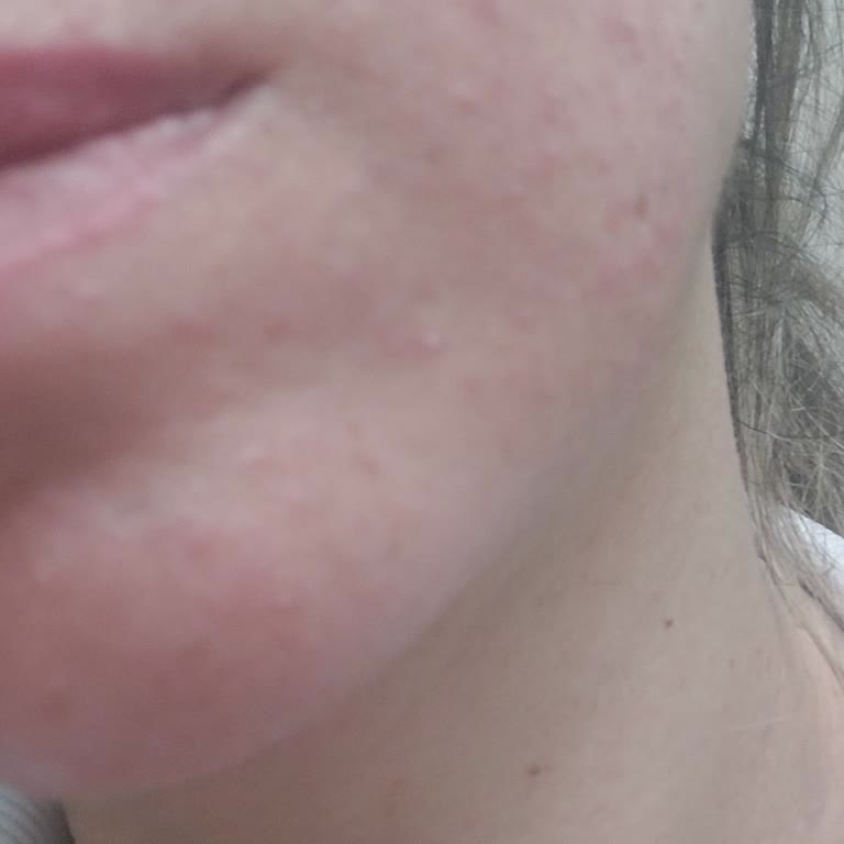 Alix Avien Face Base Cream Cildimde Tahrişe Ve Sivilcelere Sebep Oldu