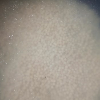 Filiz Kuskus Makarnada Böcek Çıkması Hijyen Endişesi