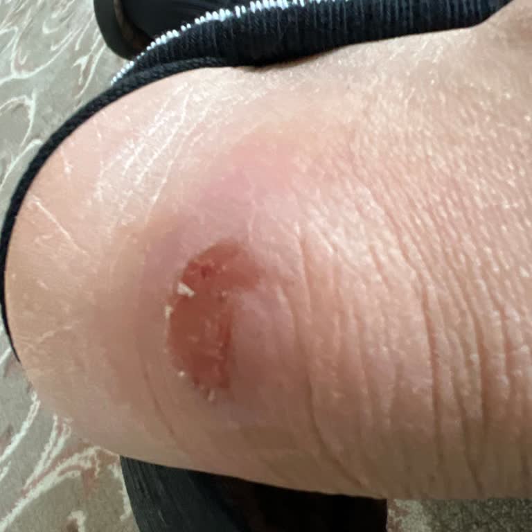 Zapatos Clásicos Dockers, solicitud de reembolso aún sin resolver