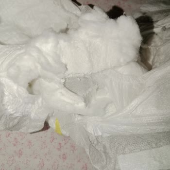 Molfix 2 Numara Bebek Bezinde Sertlik Sorunu Ve Güven Endişesi