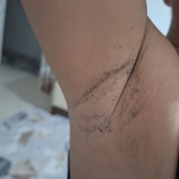 Yeni Alınan Çocuk Ürünü Kısa Sürede Tüylenme Ve Mağduriyet