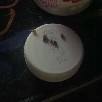 Happy Center Kefirde Taş Gibi Yabancı Maddelerle Karşılaştım, Sağlığım Tehlikeye Girdi