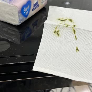 Eksik Ve Yetersiz Telafiyle Mağduriyetim Giderilmedi