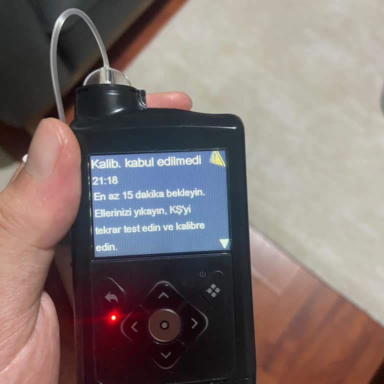 Medtronic G3 Sensör Ölçümlerinde Ciddi Uyumsuzluk Sorunu