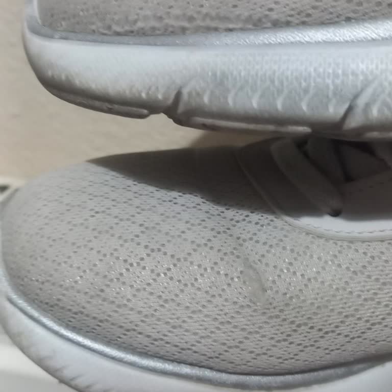 Skechers Summit Ayakkabım Kısa Sürede Açıldı, Değişim Talebim Reddedildi