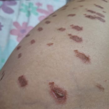 Lilith Güzellik Merkezi Akyurt Hüsranı!