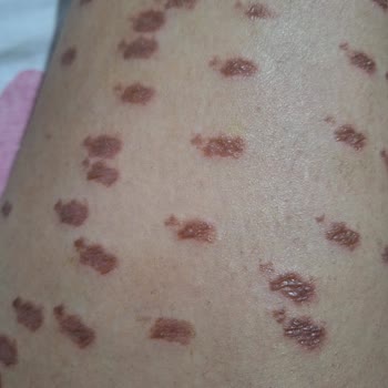 Lilith Güzellik Merkezi Akyurt Hüsranı!