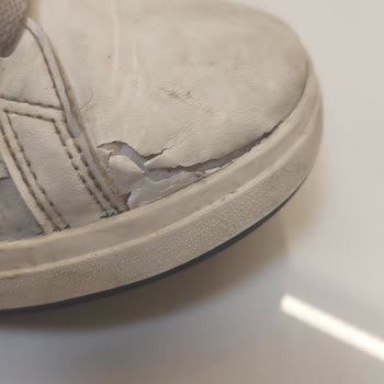 Garantili Adidas Ayakkabı Kısa Sürede Yıprandı, İnceleme Yapılmadan Ret Cevabı