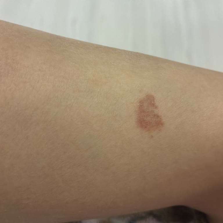 Duru Duş Jeli Sonrası Ciddi Sağlık Sorunları Yaşadım