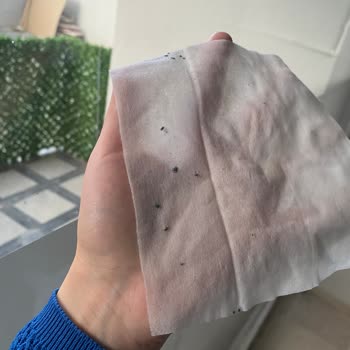 Küflü Islak Mendil Bebeğimde Pişik Ve Hassasiyete Yol Açtı