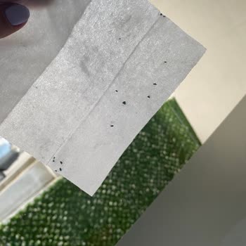 Küflü Islak Mendil Bebeğimde Pişik Ve Hassasiyete Yol Açtı