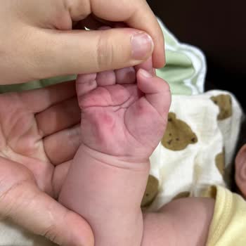 Medicana Sağlık Grubu Bebeğime Bilgim Ve Onayım Dışında Damar Yolu Açıldı, Yanıltıcı Bilgilendirme!