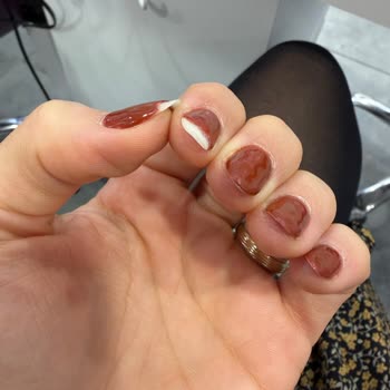 Kalıcı Oje İki Günde Soyuldu, Mağaza Çözüm Sunmadı