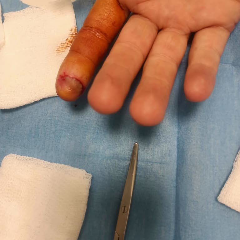 Yetersiz Müdahale Sonucu Sağlık ve Maddi Mağduriyet: Ersoy Hastanesi Kurtköy Acil Servisi Deneyimim