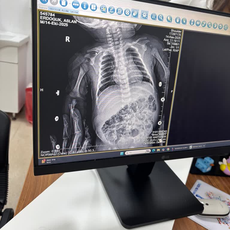 Doğum Sonrası İhmal Ve Yetersiz Müdahale Nedeniyle Mağduriyet