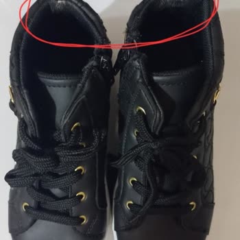 Çocuğumun Ayağını Acıtan Bot İçin İade Ve Değişim Yapılmıyor