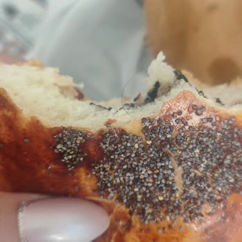 Açmanın İçinde Kıl Bulmak Hijyen Endişesi Yarattı