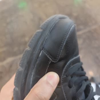 3 Ayda Açılan Skechers Ayakkabı Ve Garanti Reddi Mağduriyeti