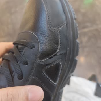 3 Ayda Açılan Skechers Ayakkabı Ve Garanti Reddi Mağduriyeti