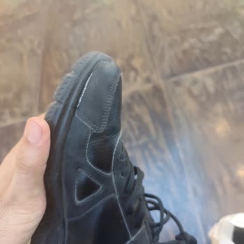 3 Ayda Açılan Skechers Ayakkabı Ve Garanti Reddi Mağduriyeti