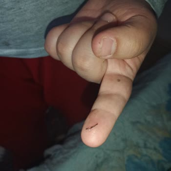 Tadelle Çikolatadan Çıkan Sert Cisim Az Daha Boğuluyordum