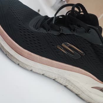 Kısa Sürede Deforme Olan Skechers Ayakkabı Hayal Kırıklığı