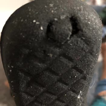 Satın Aldığım Ayakkabı Ve Pedler Kısa Sürede Çocuğumun Sağlığını Riske Attı