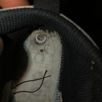 Satın Aldığım Ayakkabı Ve Pedler Kısa Sürede Çocuğumun Sağlığını Riske Attı