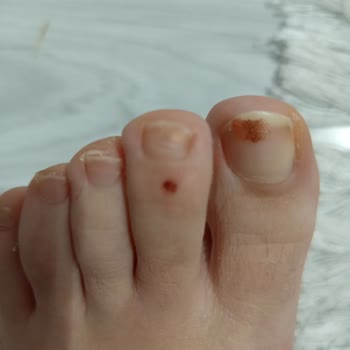 Aldığım Bot Hem Yaraladı Hem De Değişim Talebim Reddedildi