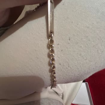 Kısa Sürede Sararan Bileklik İçin Yetersiz Çözüm Ve Değişim Talebi