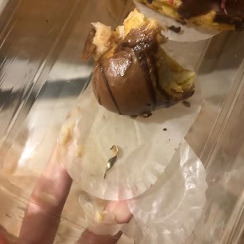 Ekler Siparişimde Demir Parçası Çıktı, Sağlığım Tehlikeye Girdi