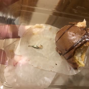 Ekler Siparişimde Demir Parçası Çıktı, Sağlığım Tehlikeye Girdi