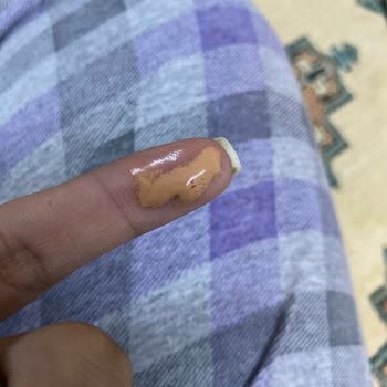 Bozuk Kapatıcı Ürünün Değişimi Talebi