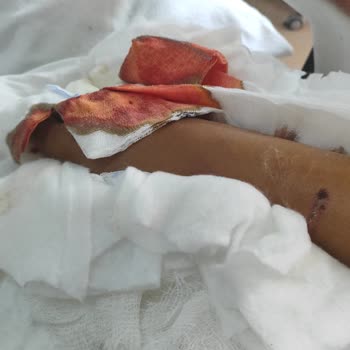 Trafik Kazası Sonrası Bilet İadesi Talebim Reddedildi, Mağduriyet Yaşıyorum