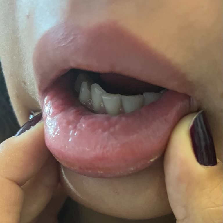 Pasta Dental Colgate causa problemas de encías y boca, pido cambio