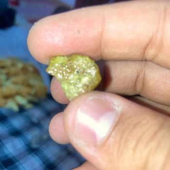 Cips Paketinden Taş Çıkmasıyla Yaşadığım Sağlık Endişesi