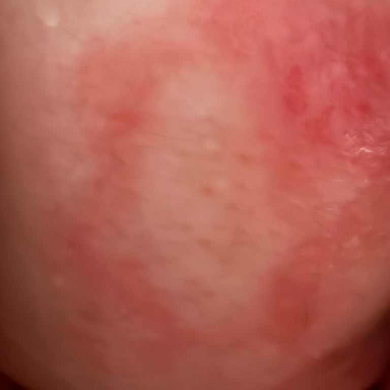 Prima Bezlerde İçerik Değişikliği Sonrası Ciddi Sağlık Sorunları