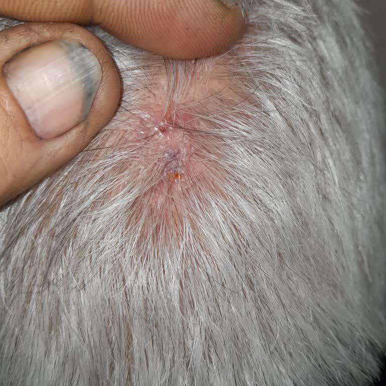 Duru Şampuan Sonrası Başımda Yaralar Ve Kaşıntı Oluştu